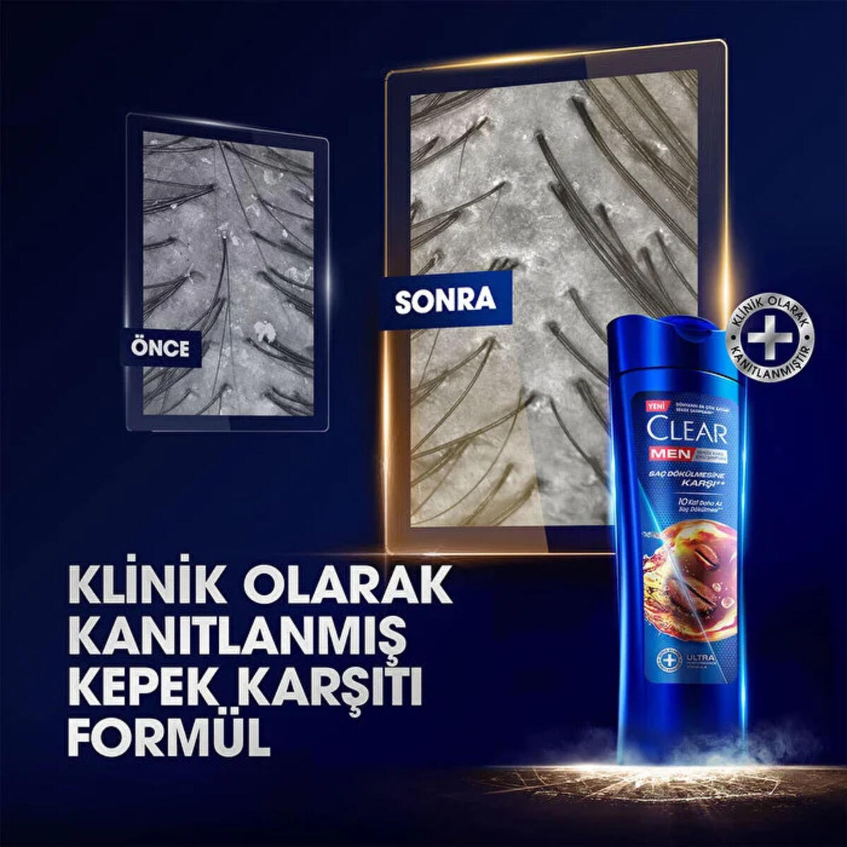 Clear Men Şampuan Saç Dökülmesine Karşı Kahve Çk. Özü 350Ml