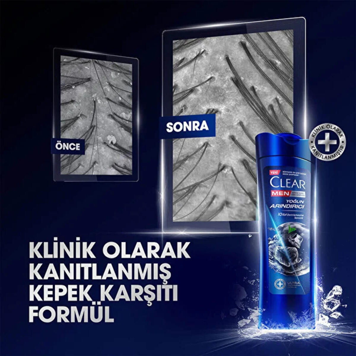 Clear Men Şampuan Yoğun Arındırıcı Kömür İle 350Ml
