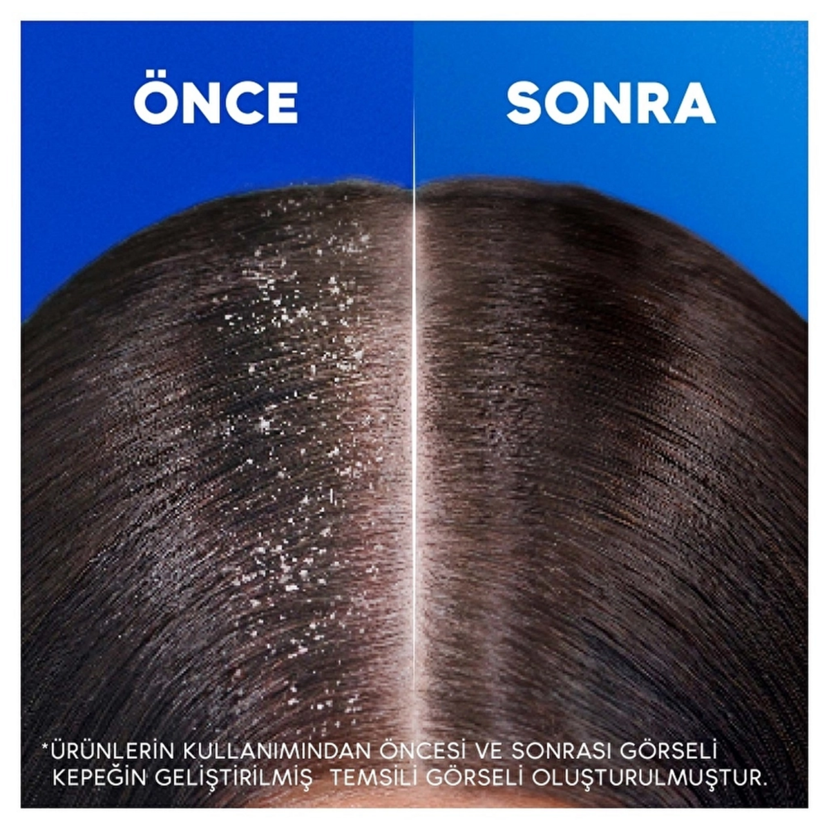 Head&Shoulders Şampuan Derin Nemlendirici 330Ml