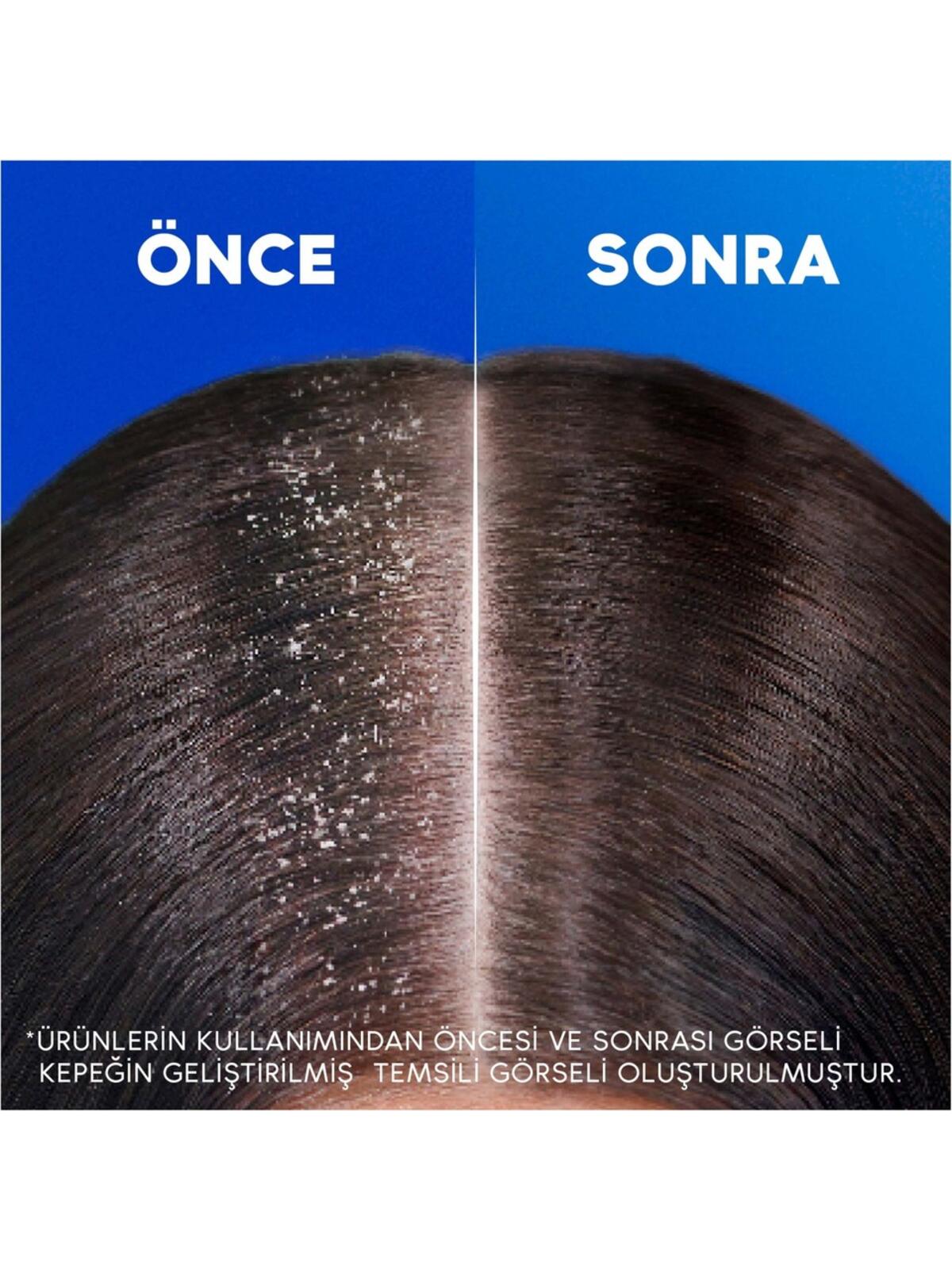 Head&Shoulders Şampuan Nemlendirici Bakım 330Ml